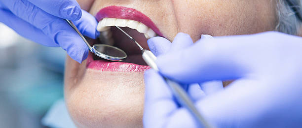 Best Emergency Tooth Extraction in Golden Glades, FL